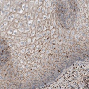Anti-USP34 antibody produced in rabbit 