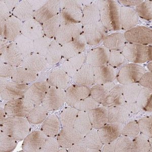 Anti-USP35 antibody produced in rabbit 