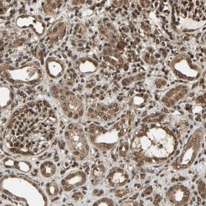 Anti-USP42 antibody produced in rabbit 