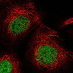 Anti-USP53 antibody produced in rabbit 