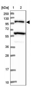 Anti-USP6NL antibody produced in rabbit 