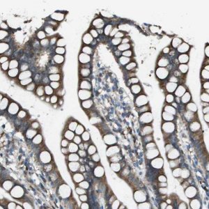 Anti-UTS2 antibody produced in rabbit 