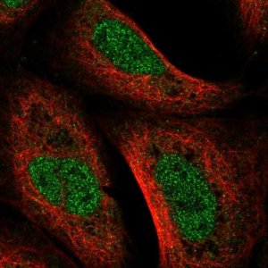 Anti-UVSSA antibody produced in rabbit 