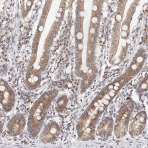 Anti-VIPAS39 antibody produced in rabbit 