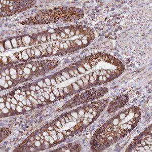 Anti-VPS16 antibody produced in rabbit 
