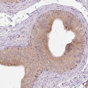 Anti-VPS25 antibody produced in rabbit 