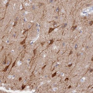Anti-VPS33B antibody produced in rabbit 