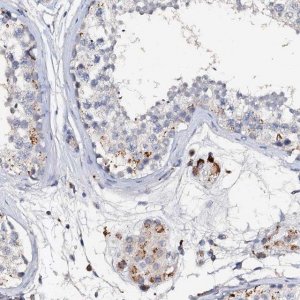 Anti-VPS36 antibody produced in rabbit 