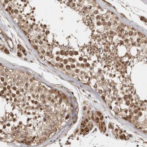 Anti-VPS50 antibody produced in rabbit 