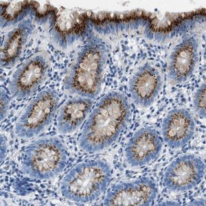 Anti-VPS53 antibody produced in rabbit 