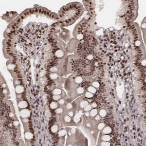 Anti-VRK3 antibody produced in rabbit 