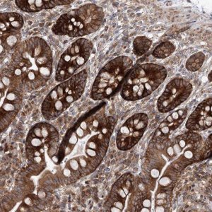 Anti-VWA2 antibody produced in rabbit 
