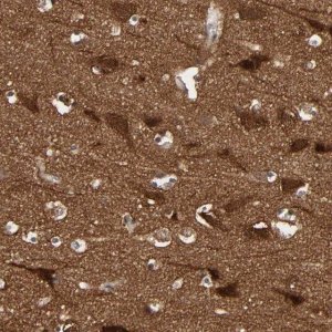 Anti-WASF1 antibody produced in rabbit HPA004105-100UL