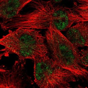 Anti-WDR19 antibody produced in rabbit 
