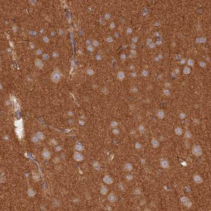 Anti-WDR41 antibody produced in rabbit 