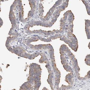 Anti-WDR77 antibody produced in rabbit 