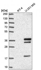 Anti-WDR82 antibody produced in rabbit 