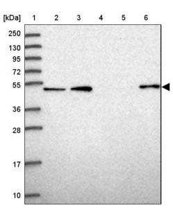 Anti-WSCD2 antibody produced in rabbit 
