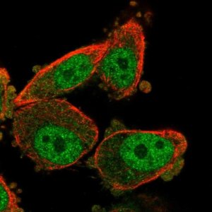 Anti-WT1 antibody produced in rabbit 