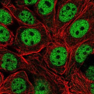 Anti-XPOT antibody produced in rabbit 