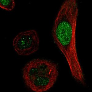 Anti-XRCC3 antibody produced in rabbit 