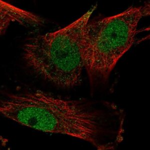 Anti-YEATS2 antibody produced in rabbit 