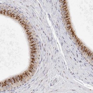 Anti-YIPF3 antibody produced in rabbit 