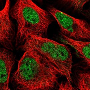 Anti-ZBED4 antibody produced in rabbit HPA045341-100UL