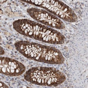 Anti-ZBTB3 antibody produced in rabbit 