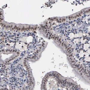 Anti-ZBTB33 antibody produced in rabbit 