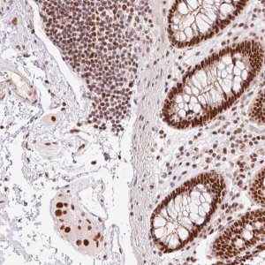 Anti-ZBTB44 antibody produced in rabbit 