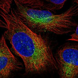 Anti-ZBTB45 antibody produced in rabbit 