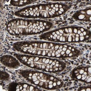 Anti-ZCCHC7 antibody produced in rabbit 
