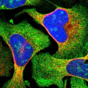 Anti-ZCCHC7 antibody produced in rabbit 