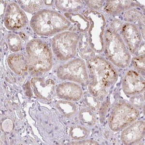 Anti-ZDHHC1 antibody produced in rabbit 
