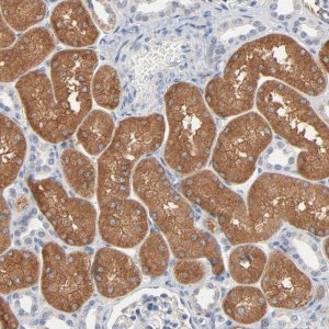 Anti-ZDHHC8 antibody produced in rabbit 