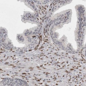 Anti-ZEB1 antibody produced in rabbit 