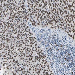 Anti-ZKSCAN3 antibody produced in rabbit 