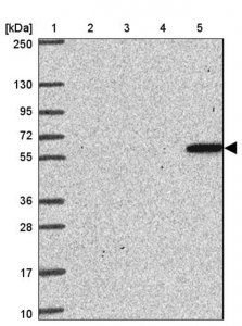 Anti-ZNF100 antibody produced in rabbit 