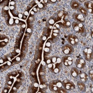 Anti-ZNF114 antibody produced in rabbit 