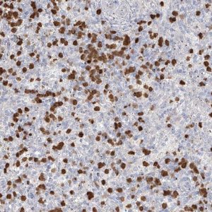 Anti-ZNF227 antibody produced in rabbit 