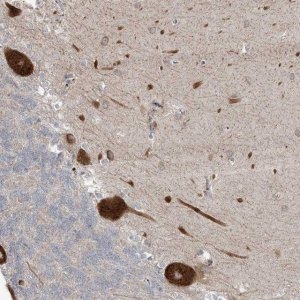Anti-ZNF263 antibody produced in rabbit 