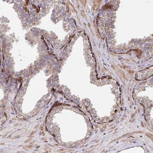 Anti-ZNF268 antibody produced in rabbit 