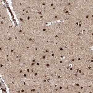 Anti-ZNF280D antibody produced in rabbit 