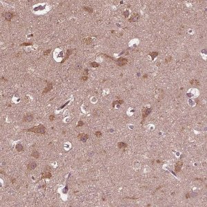 Anti-ZNF292 antibody produced in rabbit 