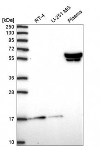 Anti-ZNF317 antibody produced in rabbit 