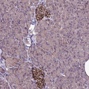 Anti-ZNF329 antibody produced in rabbit 