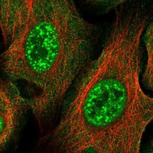 Anti-ZNF337 antibody produced in rabbit 