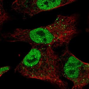 Anti-ZNF341 antibody produced in rabbit 