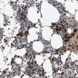 Anti-ZNF366 antibody produced in rabbit 